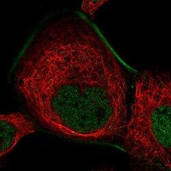 ZFP62 Antibody, Novus Biologicals 25 &mu;L, Unlabeled:Antibodies, Polyclonal